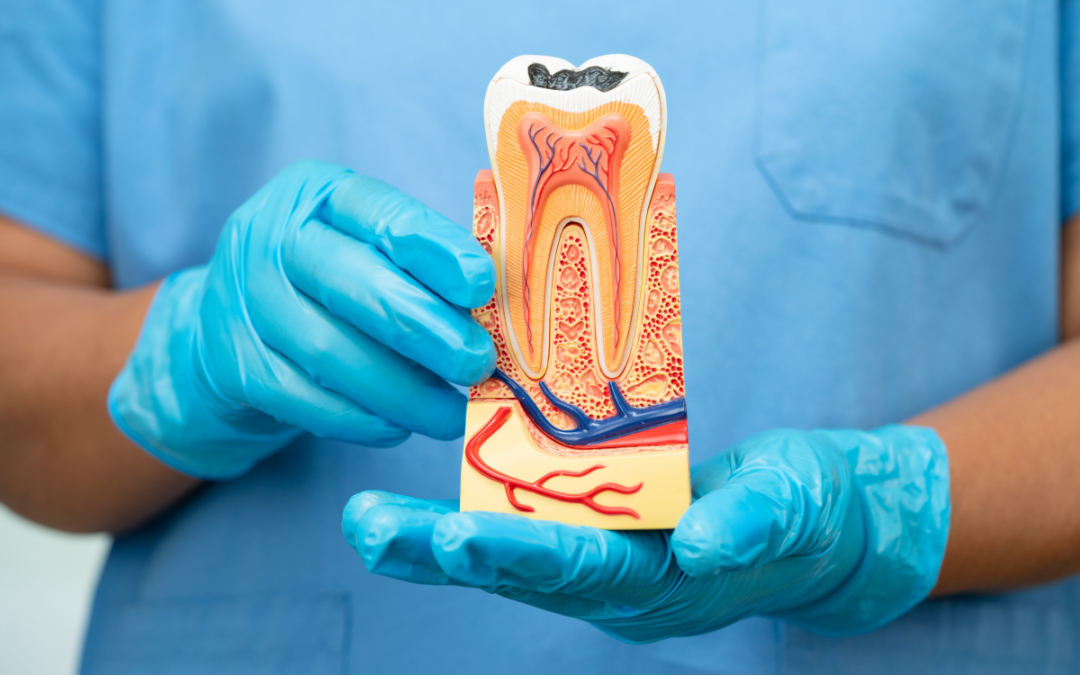 Root Canals: The Truth About This Common Dental Procedure
